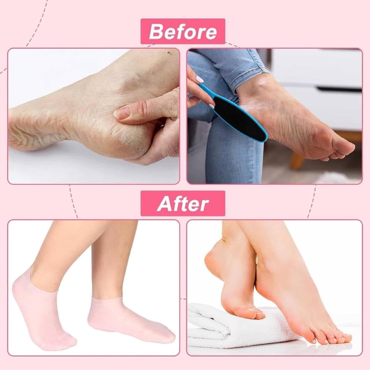 Silicone Gel Moisturizing Socks for Cracked Heels – Reusable Hydrating Spa Socks for Dry Feet, Heels & Callus Repair (Pack of 2)