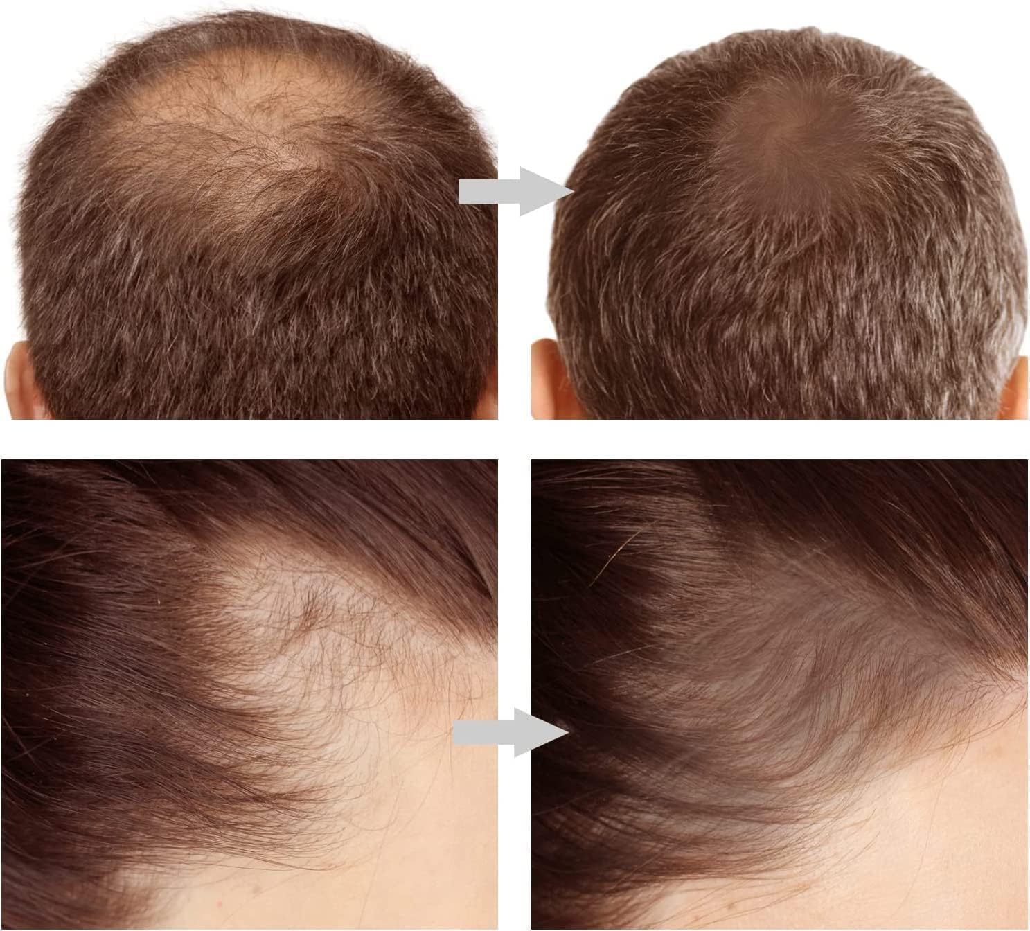 Hairline Shadow Powder